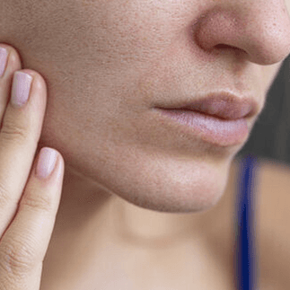 Dry Skin