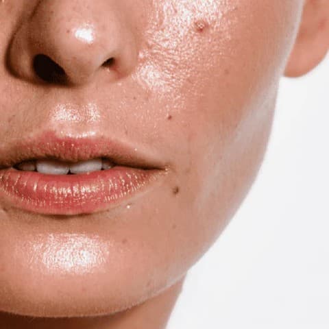 Oily Skin